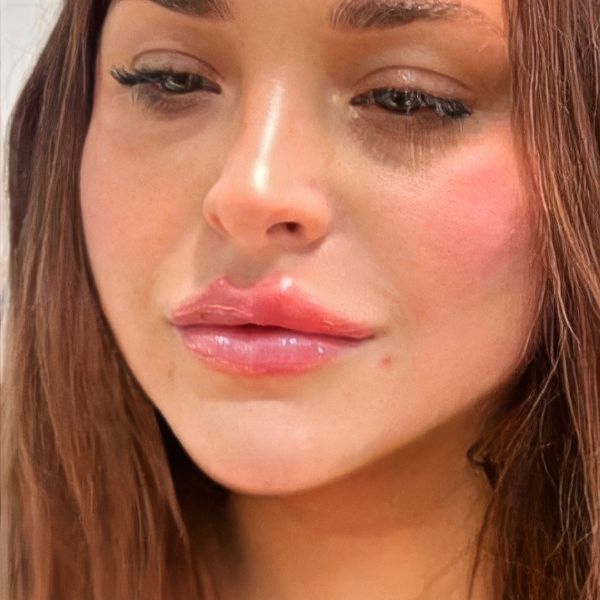 After treatment - Patient 3