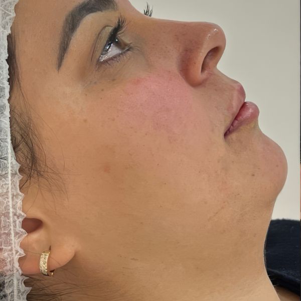 Before treatment - Patient 2